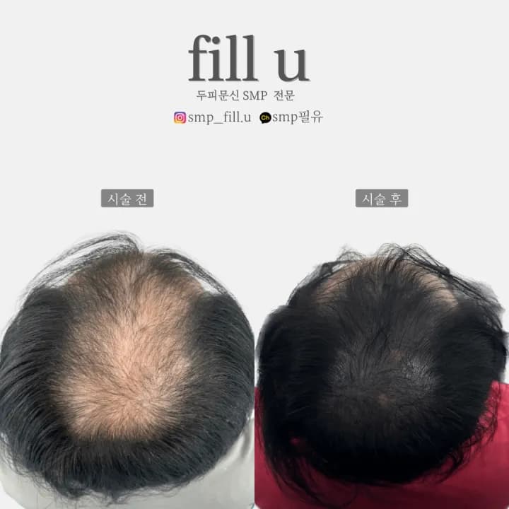 ์ ์๋ฆฌ ํ๋ชจ ๋ํผ๋ฌธ์ SMP