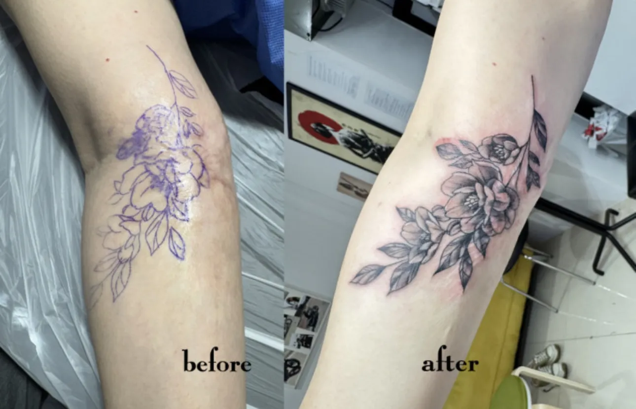 ํ๊ฟ์น ํ์์๊ตญ ํํฐ ๋ฏธ๋์ปค๋ฒ์
- 1