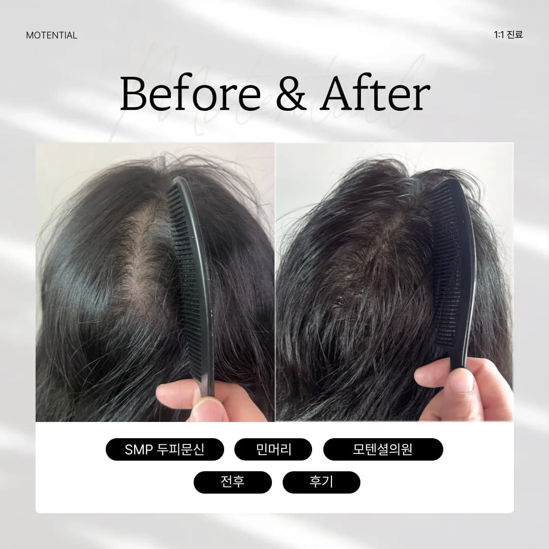 ์ฌ์ ๋ท๊ฐ๋ง + ํค์ด๋ผ์ธ