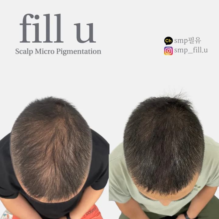 ์ ์๋ฆฌ ํ๋ชจ ์ปค๋ฒ SMP ๋ํผ๋ฌธ์