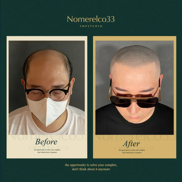 ์ญ๋ฐ ๋ฌธ์ (BSMP ๊ธฐ๋ฒ)