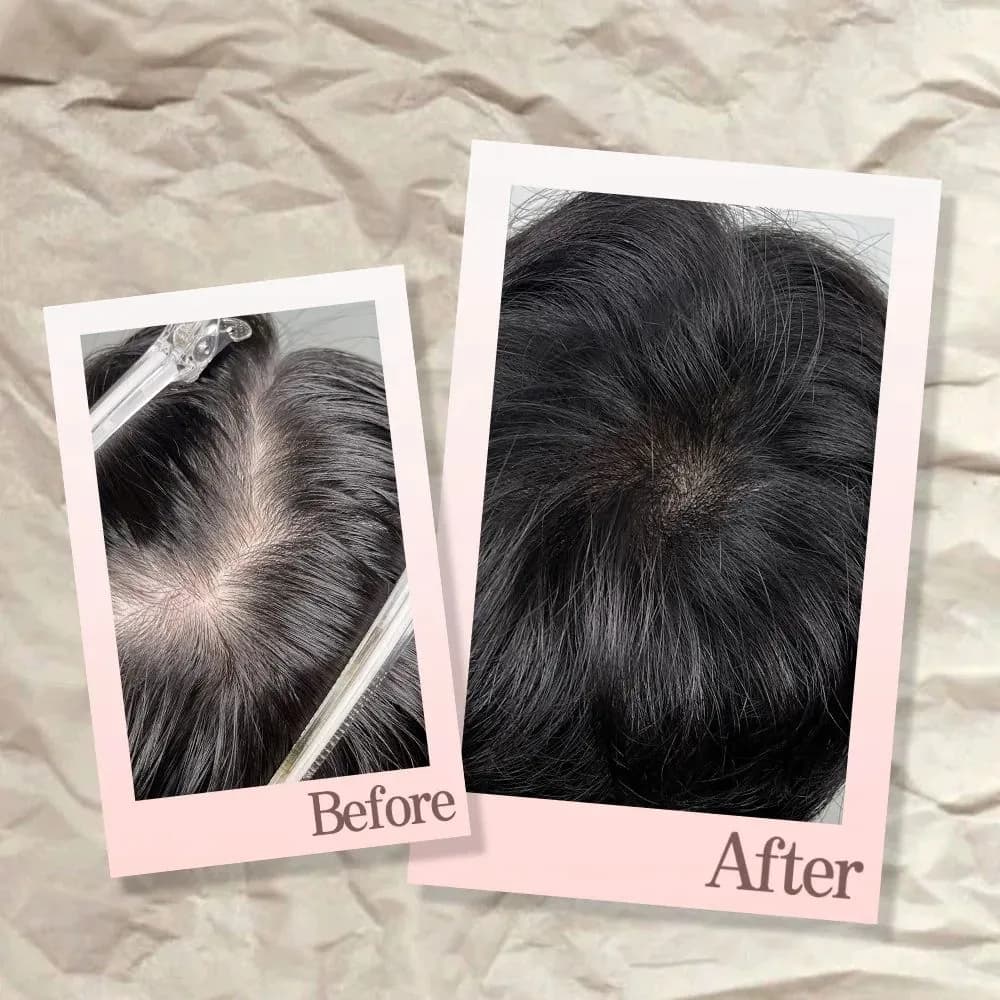 가르마탈모커버