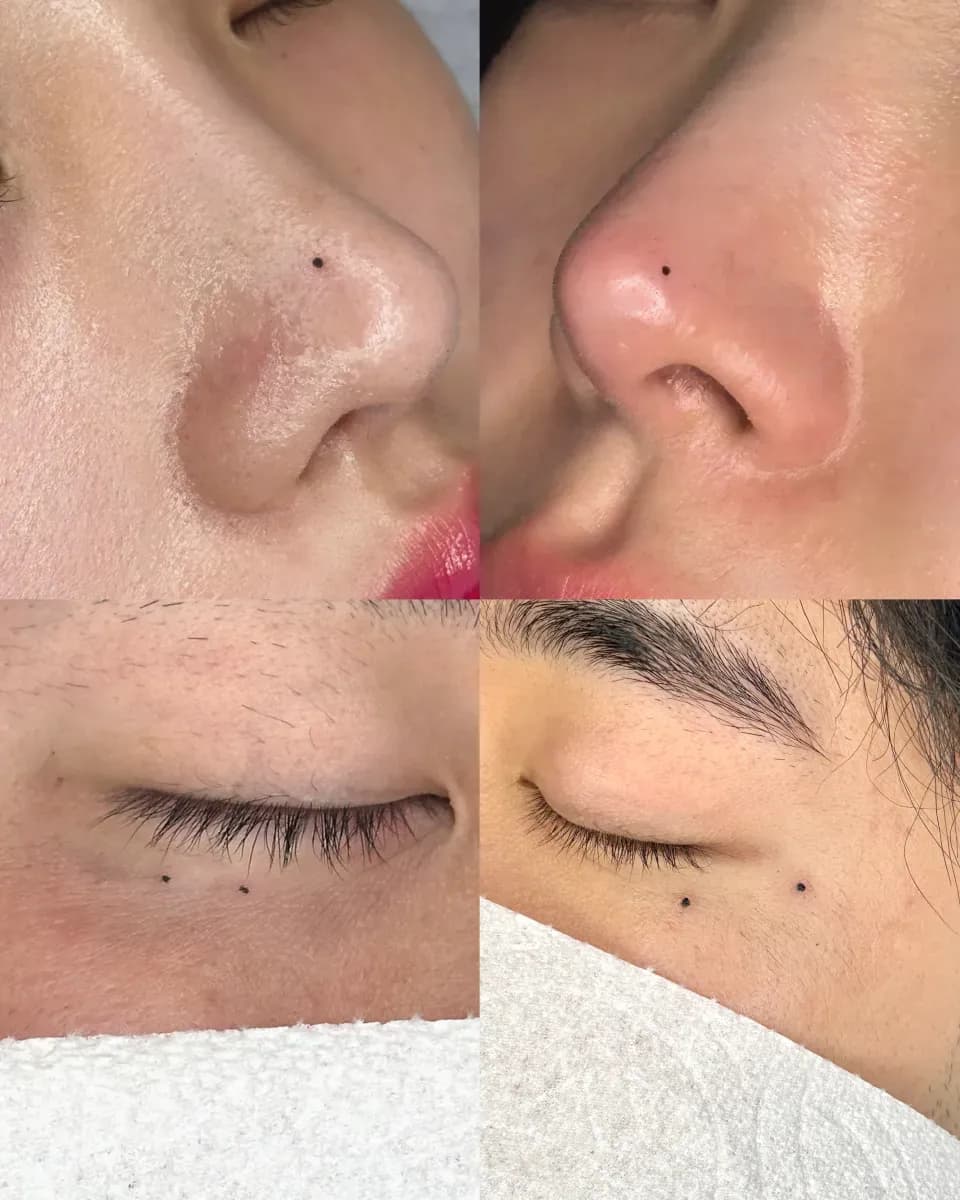 미인 점 타투 - 1