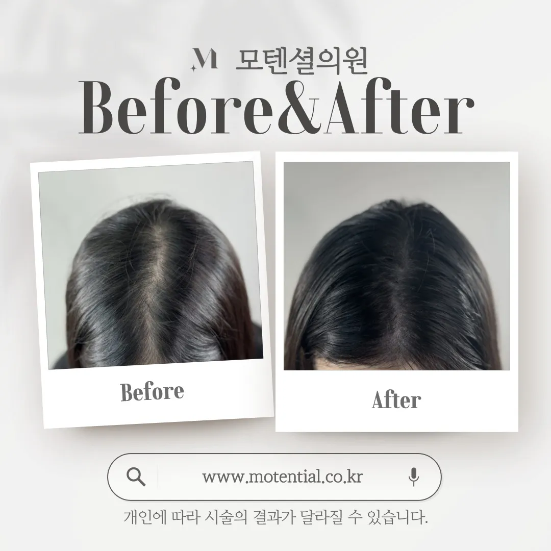 ์ฌ์ ๋ํผ๋ฌธ์