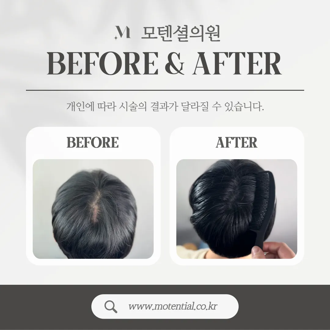 ๋ํผ๋ฌธ์