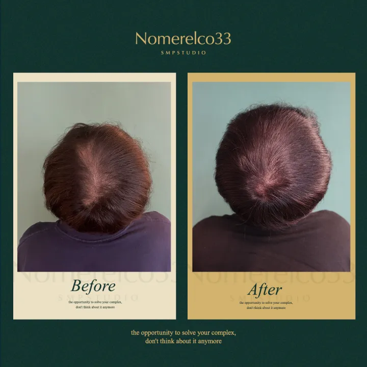 ์ ์๋ฆฌ ์ ์ฒด ๋ฐ๋๋ณด๊ฐ