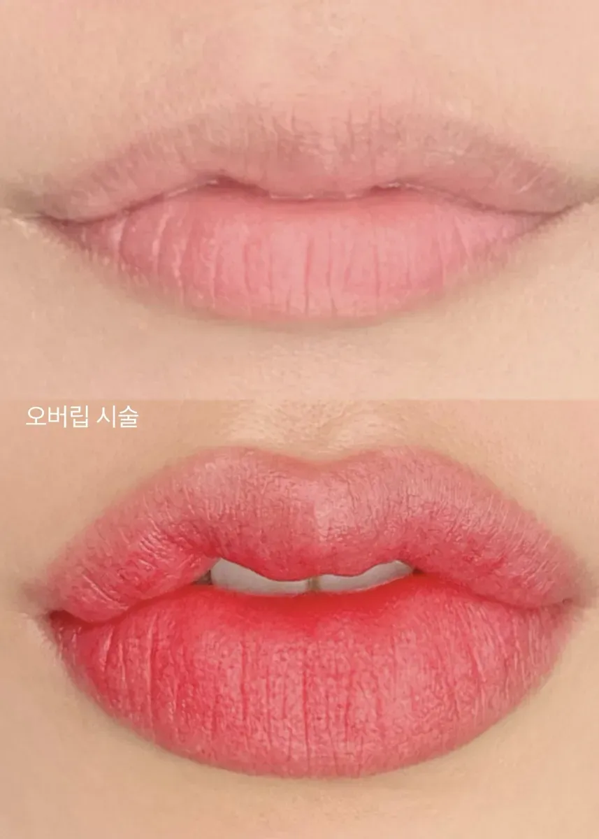 오버립 입술문신