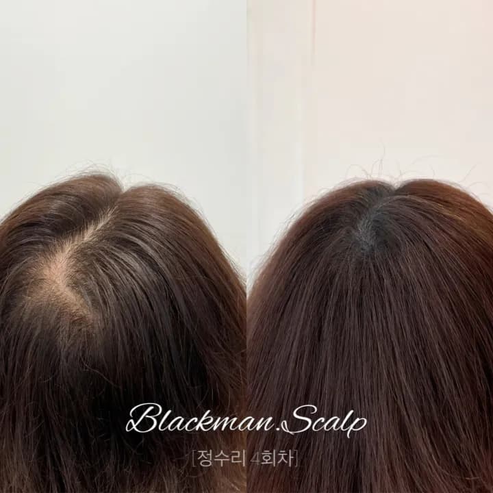 ๊ฐ๋ฅด๋ง์ ์๋ฆฌ๋ํผ๋ฌธ์