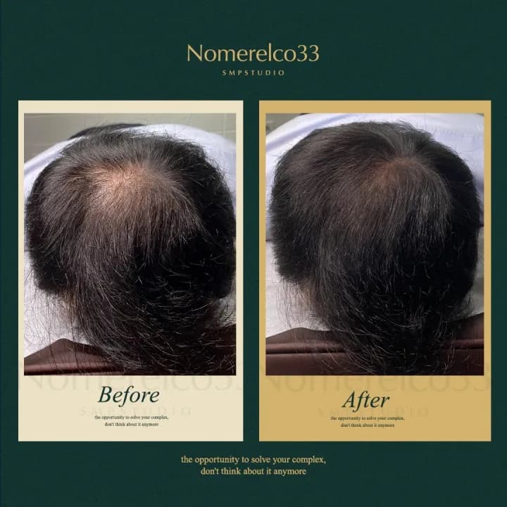 ๋จ์ฑ ์ ์๋ฆฌ ํ๋ชจ ์ปค๋ฒ