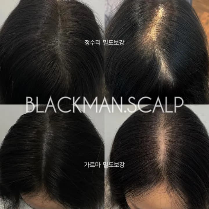 ๊ฐ๋ฅด๋ง ์ ์๋ฆฌ ๋ํผ๋ฌธ์