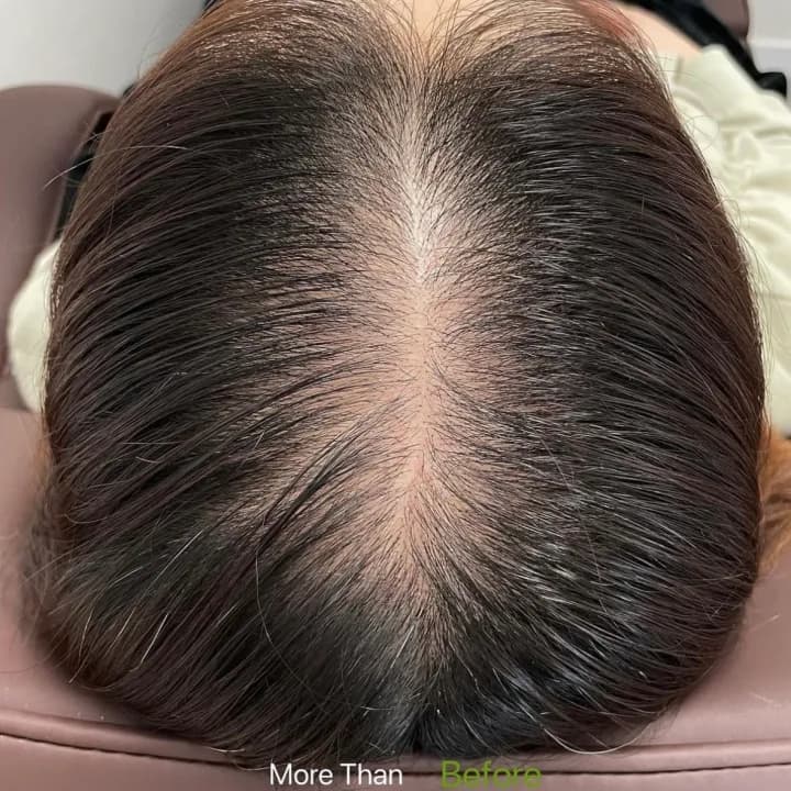 ์ฌ์ฑ ๊ฐ๋ฅด๋ง ์ปค๋ฒ