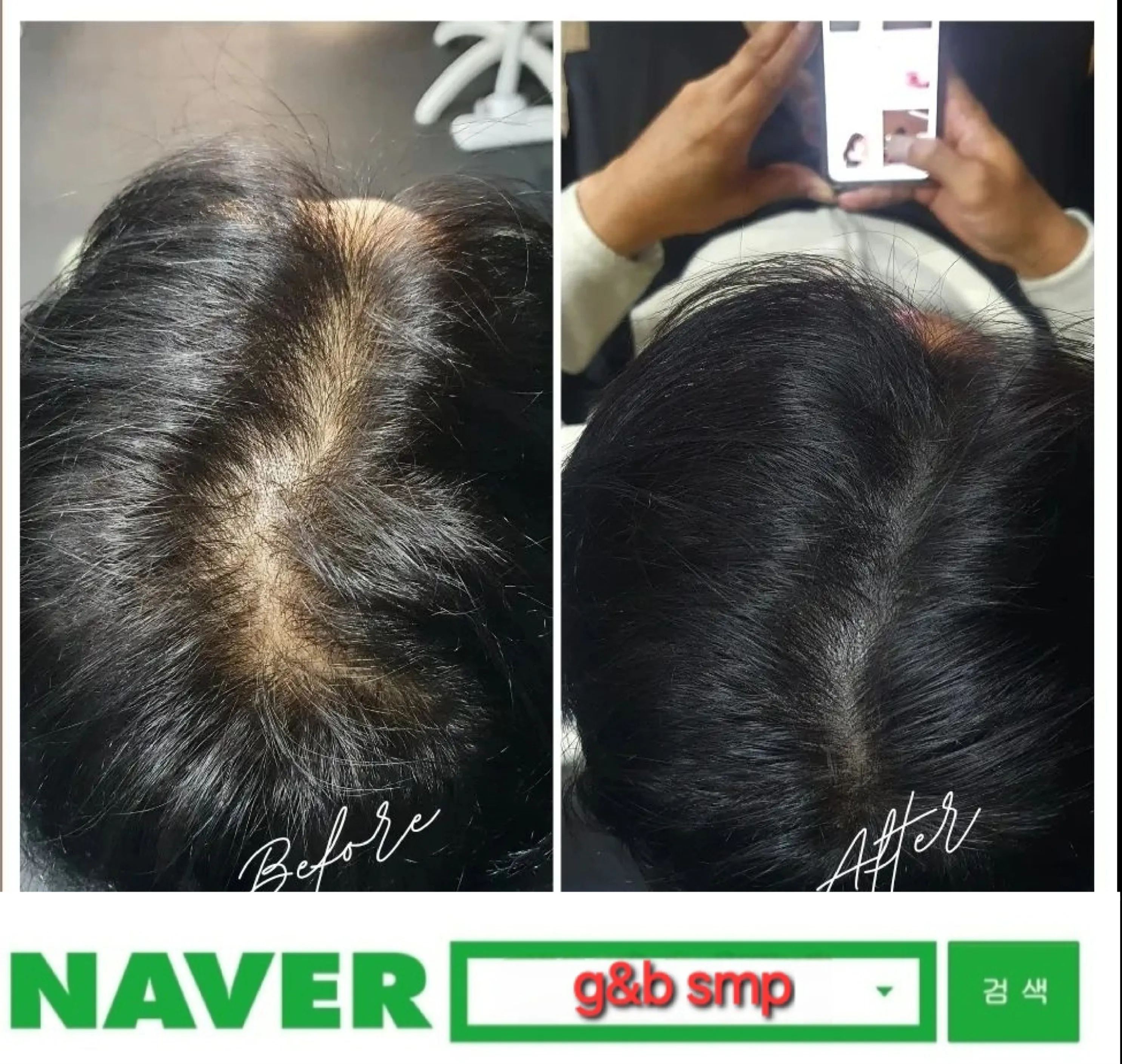 ๊ฐ๋ฅด๋ง