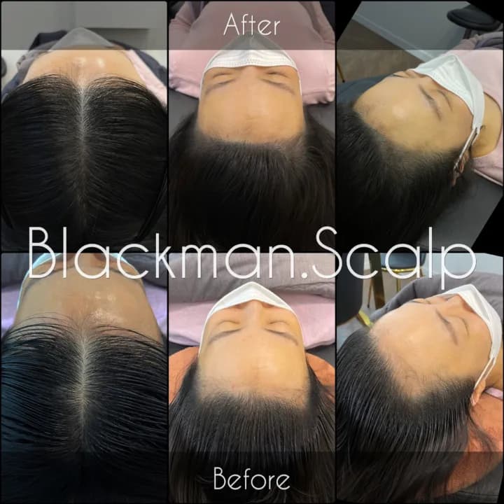 ๋ํผ๋ฌธ์